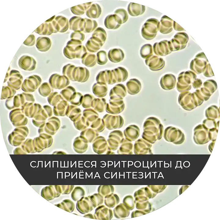 До: микроциркуляция